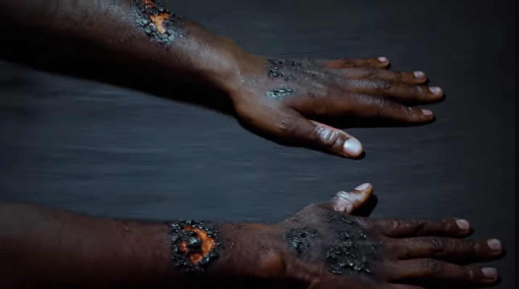Two outstretched hands marked with burns and glowing embers